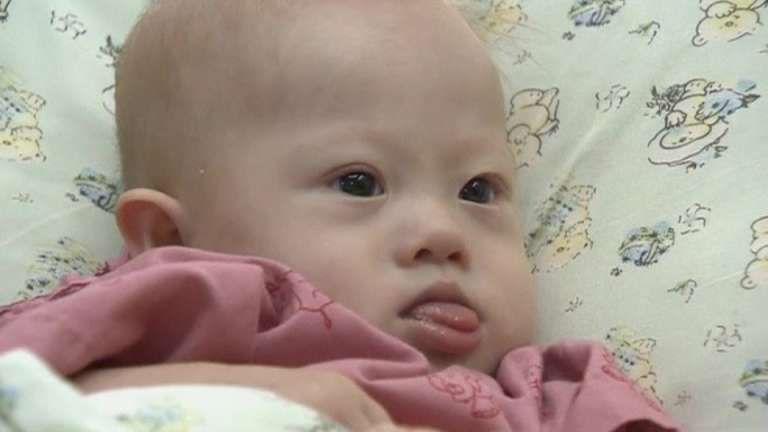 Thai surrogate vows to keep Down's syndrome baby
