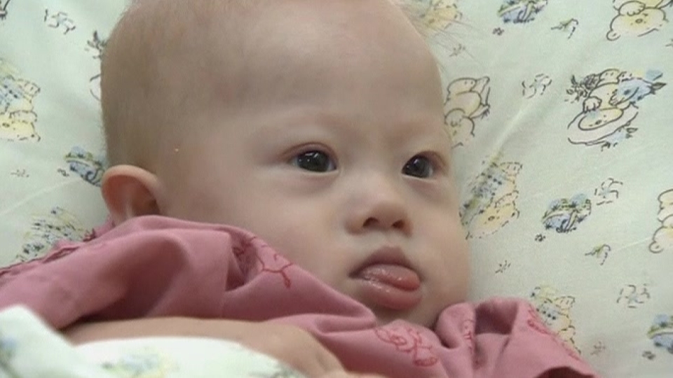 Thai surrogate vows to keep Down's syndrome baby