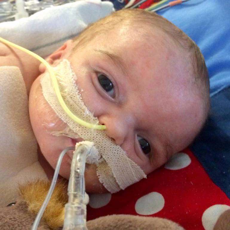 baby needing heart transplant