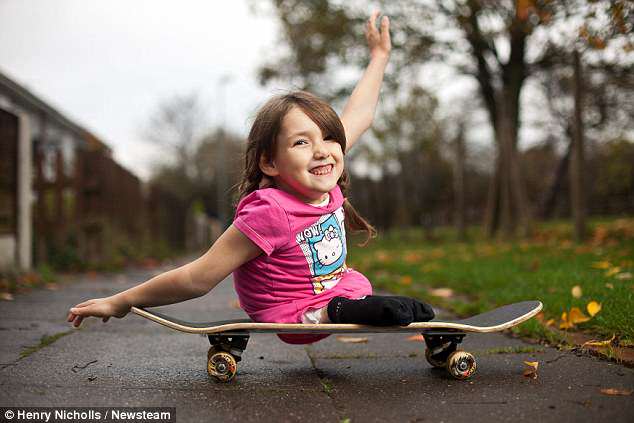 skateboarder with no legs