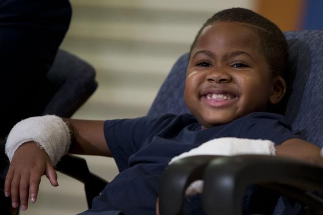 double-hand-transplant-child
