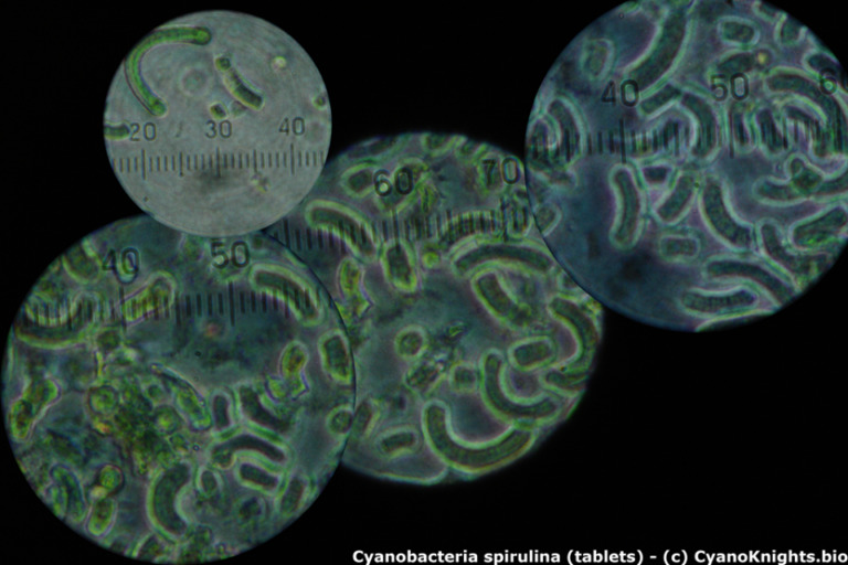 cynobacteria 2