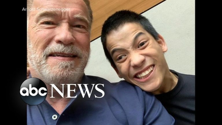 arnold body builder with cerebral palsy