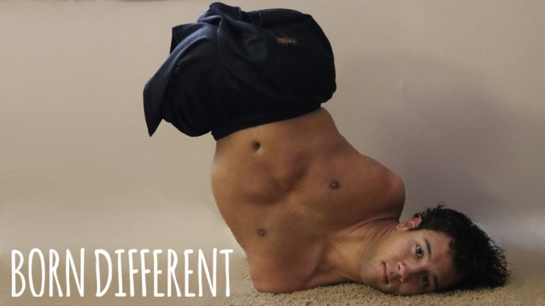 born-different-man-born-without